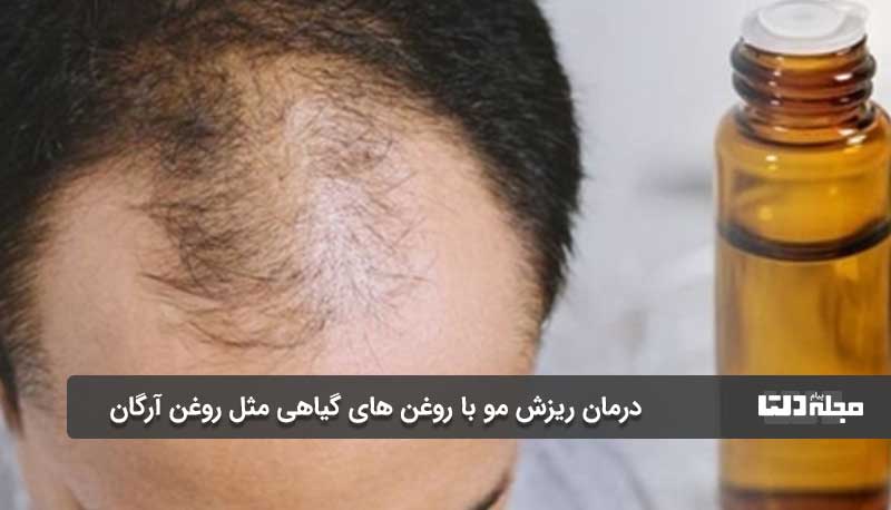 درمان ریزش مو با روغن های گیاهی مثل روغن آرگان